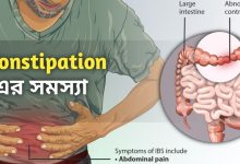 Constipation