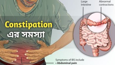 Constipation