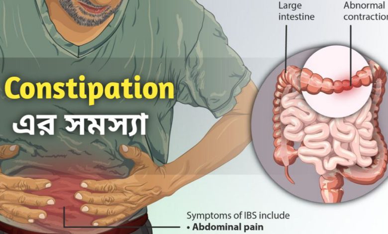 Constipation