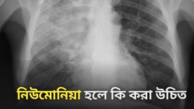 Pneumonia