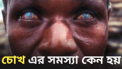 Eye