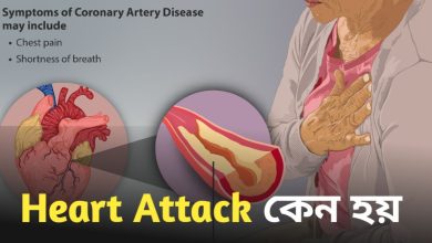 Heart Attack
