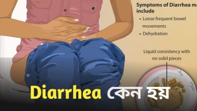 Diarrhea