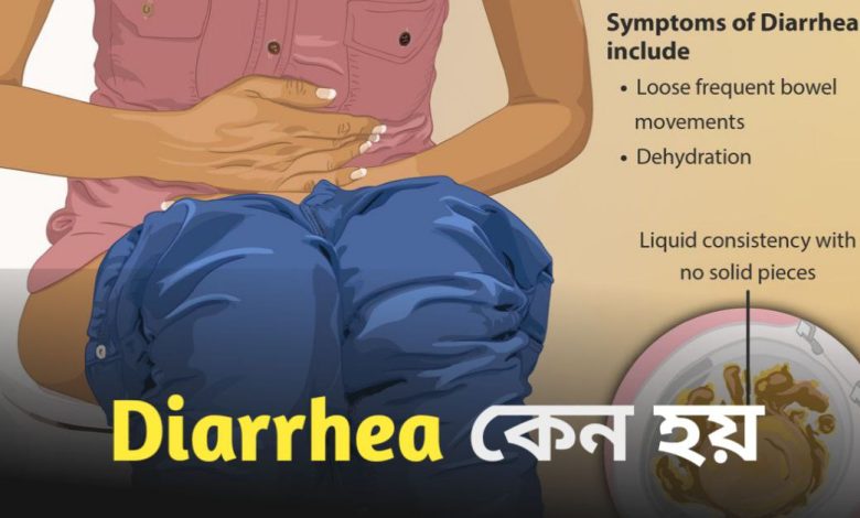 Diarrhea