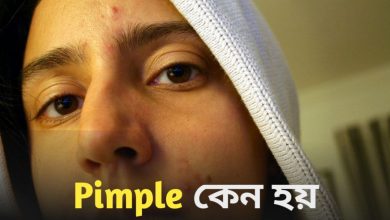 Pimple