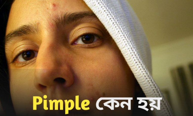 Pimple