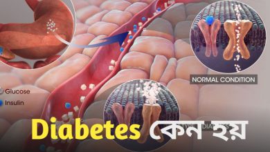Diabetes