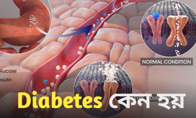 Diabetes
