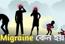 Migraine