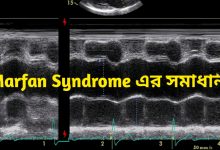 Marfan Syndrome