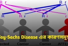 Tay-Sachs Disease