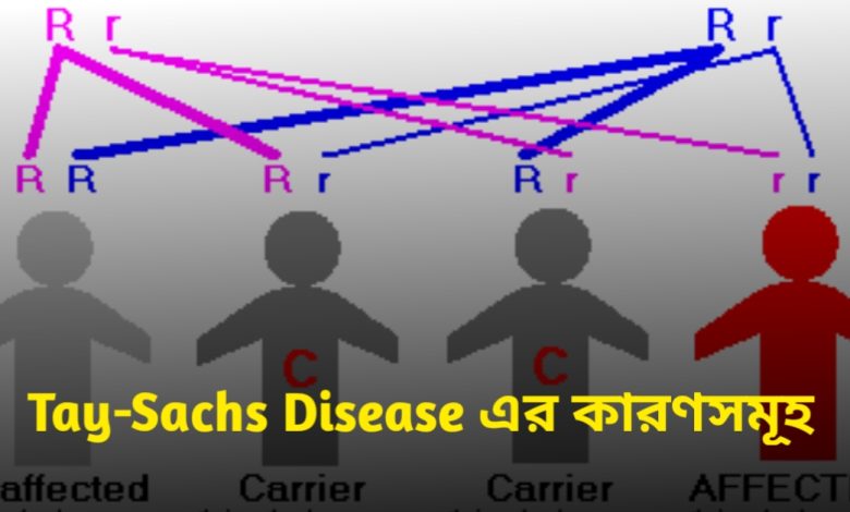 Tay-Sachs Disease